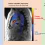 Unstable ‘fluttering’ predicts aortic aneurysm with ninety eight% precision